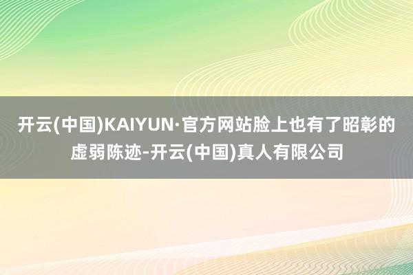 开云(中国)KAIYUN·官方网站脸上也有了昭彰的虚弱陈迹-开云(中国)真人有限公司
